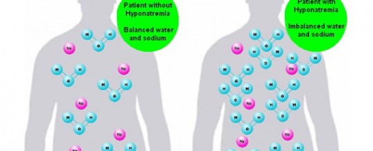 Hyponatremia – Is there such a thing as too much water?